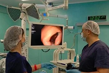 В онкоцентре женщине удалили большую опухоль сигмовидной кишки, не уходя в полостную операцию  В онкоцентре женщине удалили большую опухоль сигмовидной кишки, не уходя в полостную операцию